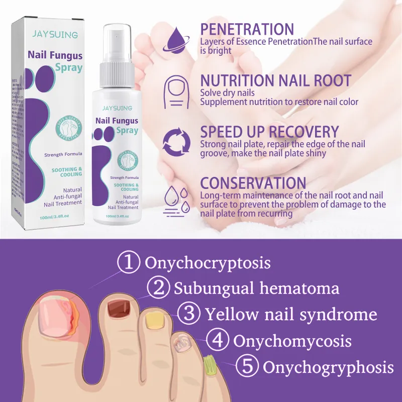 NAIL FANGUS SPRAY