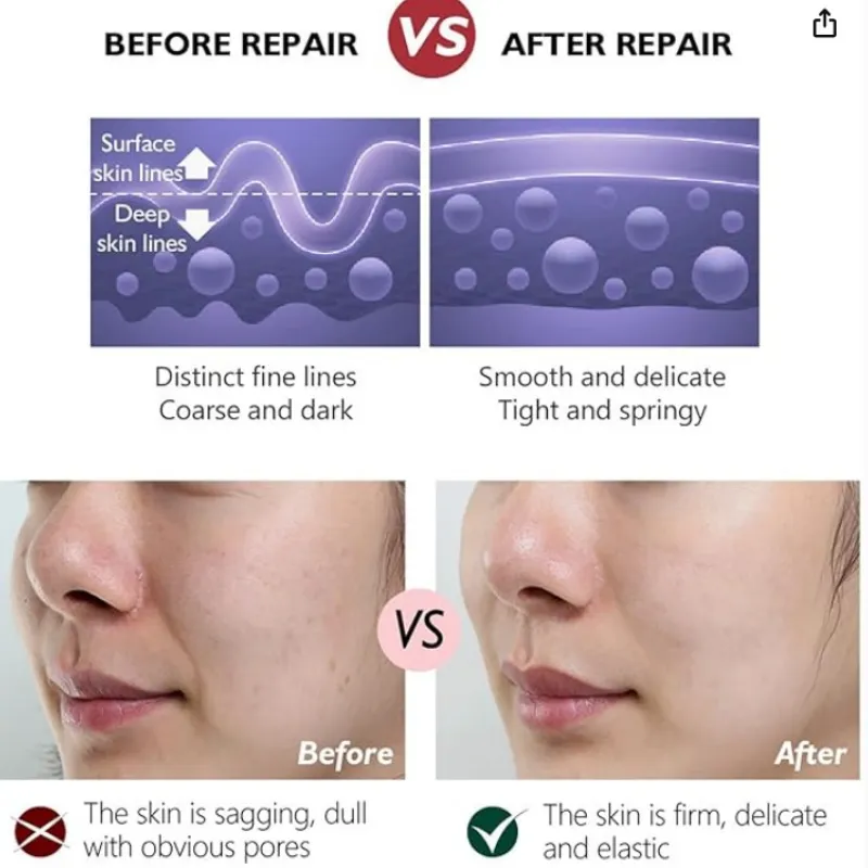 • Retinol cream (Anti-Aging)