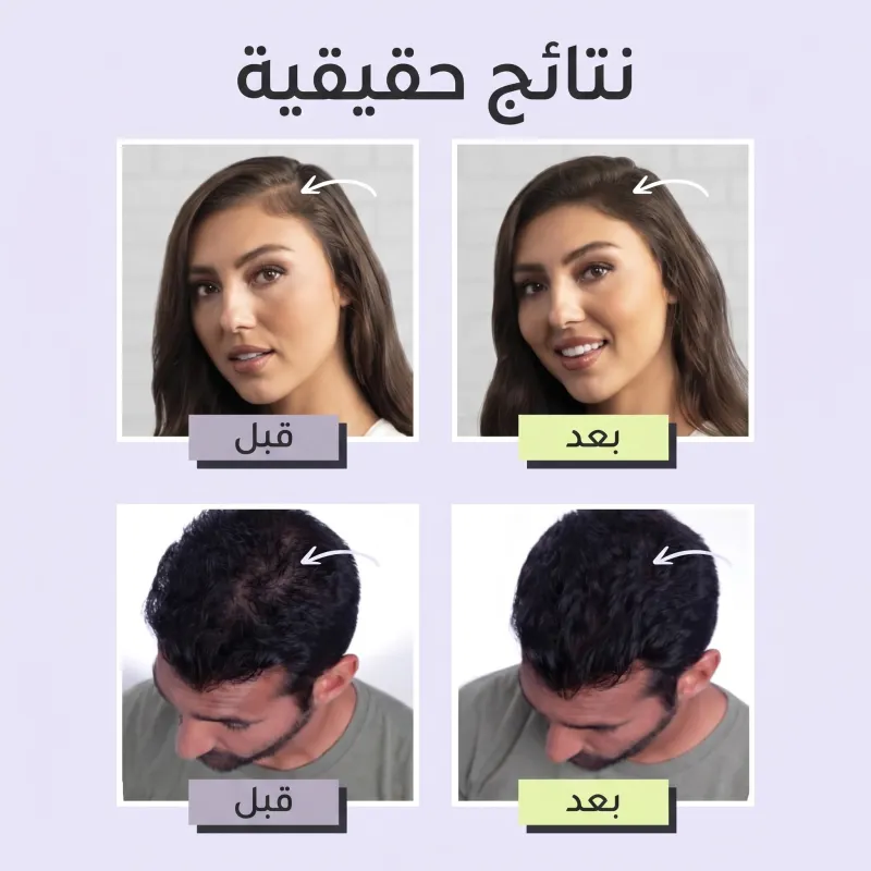 الياف لملء فراغات الشعر من Toppik