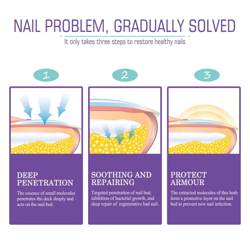 NAIL FANGUS SPRAY