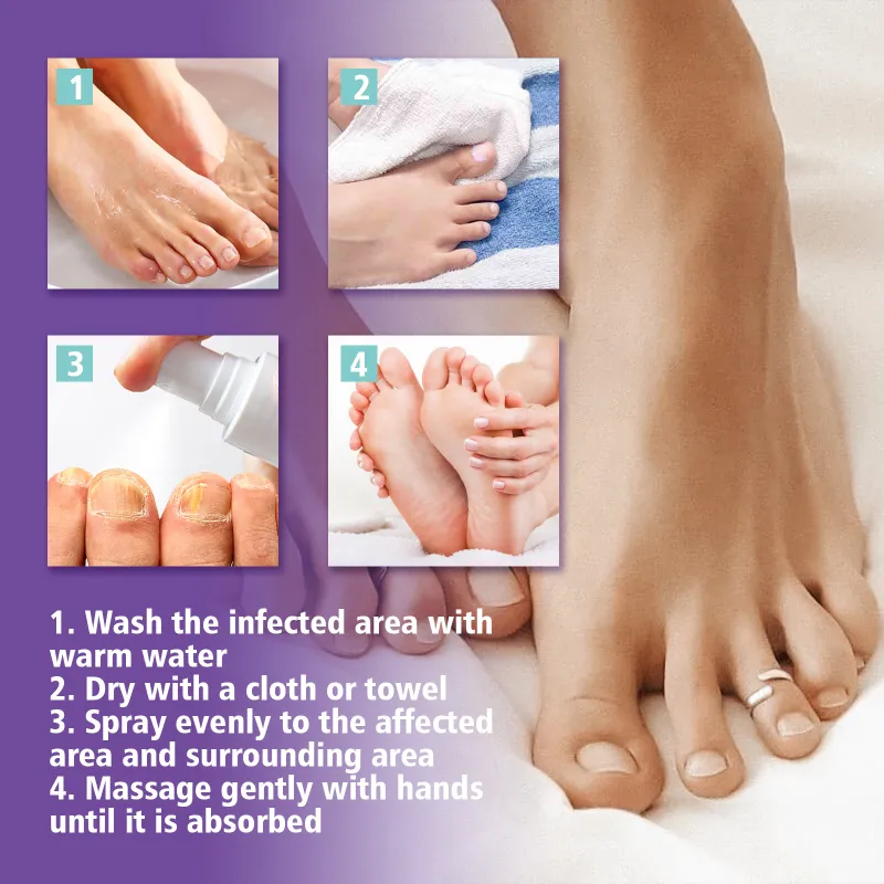 NAIL FANGUS SPRAY